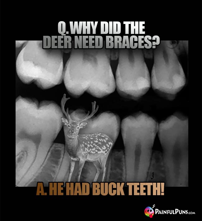 Q. Why did the deer need braces? A. He had buck teeth!