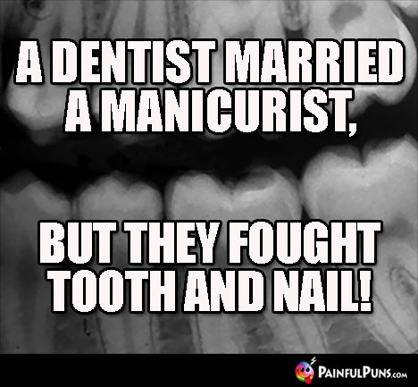 A dentist married a manicurist, but they fought like tooth and nail!
