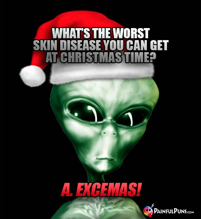 What's the worst skin disease you can get at Christmas time? A. Excemas!