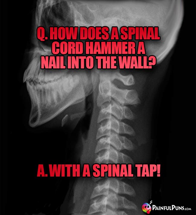 Q. How does a spinal cord hammer a nail into the wall? A. with a spinal tap!